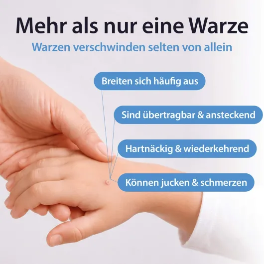 Acetocaustin Stift gegen Warzen 3 ml