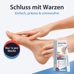 Acetocaustin Stift gegen Warzen 3 ml