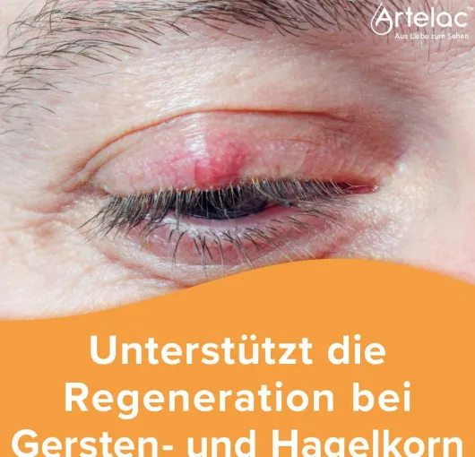 Artelac Augenlidhelfer Salbe 15 g