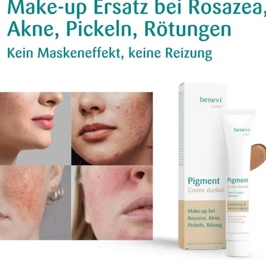 Benevi Color Pigmentcreme Dunkel 20 ml
