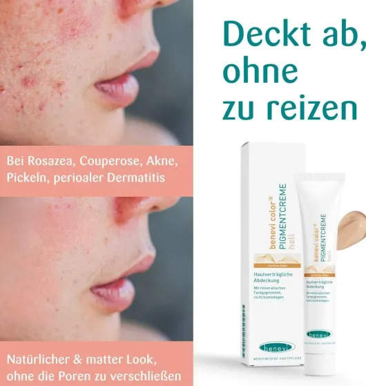 Benevi Color Pigmentcreme Hell 20 ml