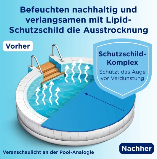 Bepanthen Augentropfen Intense 10 ml