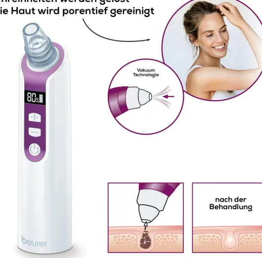 Beurer Porenreiniger FC 41