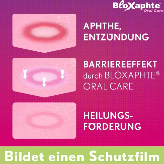 Bloxaphte Oral Care Junior Gel 15 ml