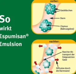 Espumisan Emulsion 30 ml