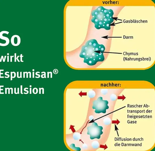 Espumisan Emulsion 30 ml