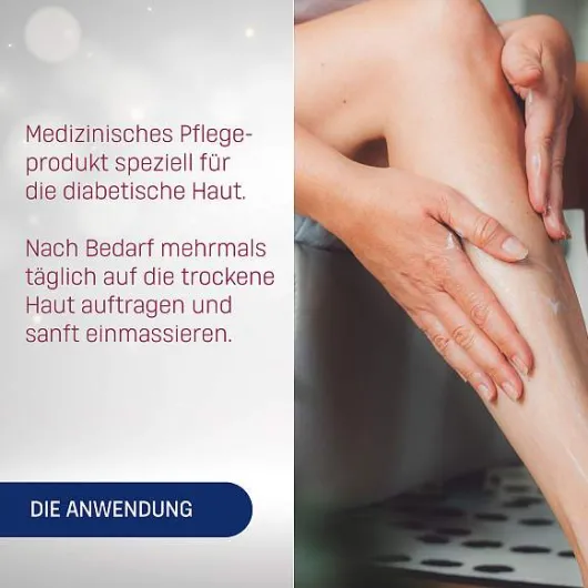 Eubos Diabetische Haut Körperbalsam 150 ml Lotion