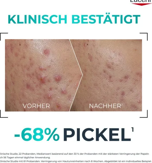 Eucerin DermoPure Clinical Probiom 8 Routine-Set 1 Stück + gratis Eucerin Sun Gel - Creme Oil Control 20 ml