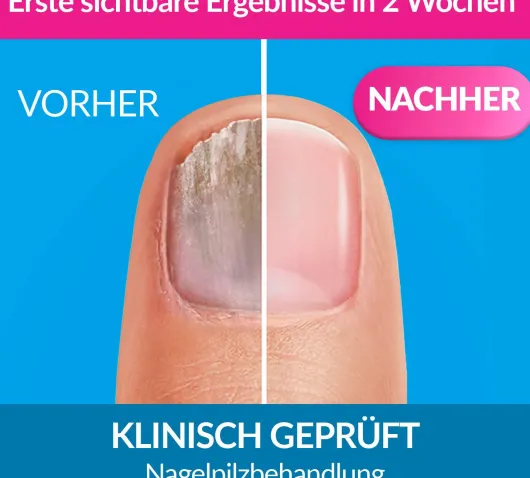 Excilor 3,3 ml Lösung Gegen Nagelpilz