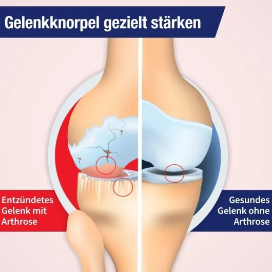 Gelencium Arthro Tropfen zum Einnehmen 50 ml