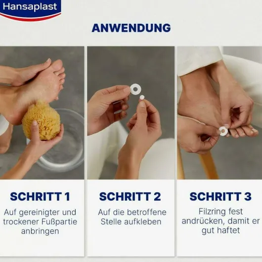 Hansaplast Druckschutzring Klein 20 Stück