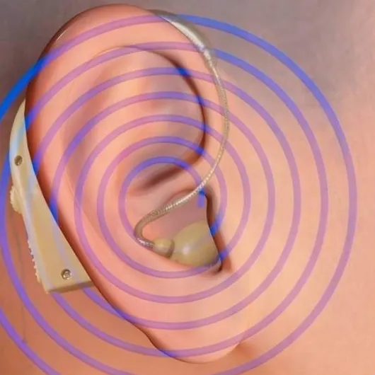 Hörverstärker Sound Genie