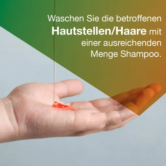 Ketozolin 2 % Shampoo 120 ml