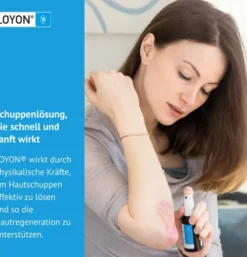 Loyon bei Schuppigen Hauterkrankungen Lösung 15 ml