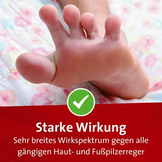Mykosert Spray bei Haut- und Fußpilz 30 ml