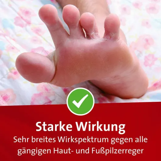 Mykosert Spray bei Haut- und Fußpilz 2 x 30 ml