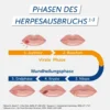 Pencivir bei Lippenherpes 2 g Creme