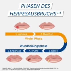Pencivir bei Lippenherpes 2 g Creme