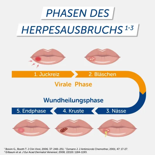 Pencivir bei Lippenherpes 2 g Creme