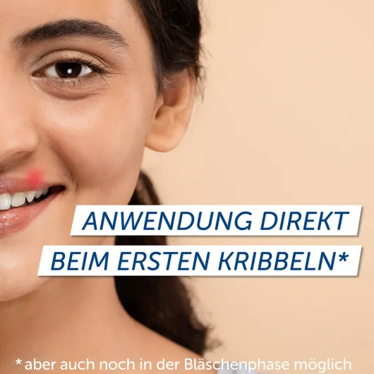 Pencivir bei Lippenherpes 2 g Creme