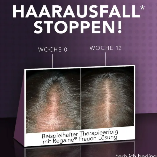 Regaine Frauen Lösung 3 x 60 ml