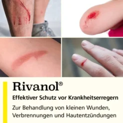 Rivanol 50g Salbe