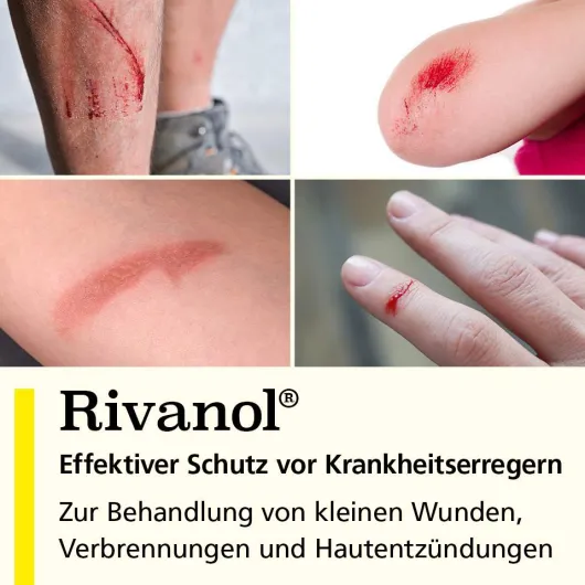 Rivanol 50g Salbe
