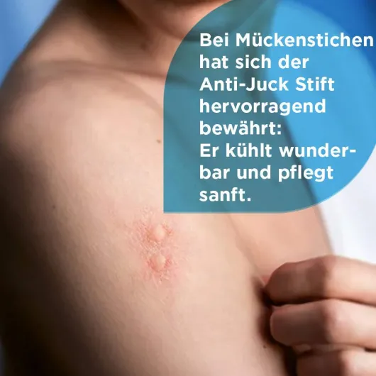 Soventol Anti - Juck Stift 4 ml Gel