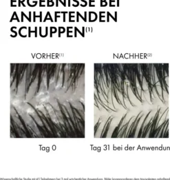 Vichy Dercos Anti-Schuppen Shampoo Trockene Kopfhaut 390 ml