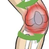 Vital Komfort Kniebandage PatellaTec Gr. XL