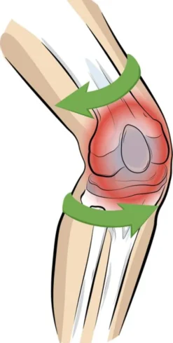 Vital Komfort Kniebandage PatellaTec Gr. XL